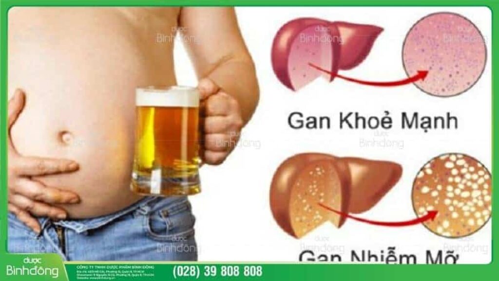 Gan nhiễm mỡ bao nhiêu là cao? 1916033634