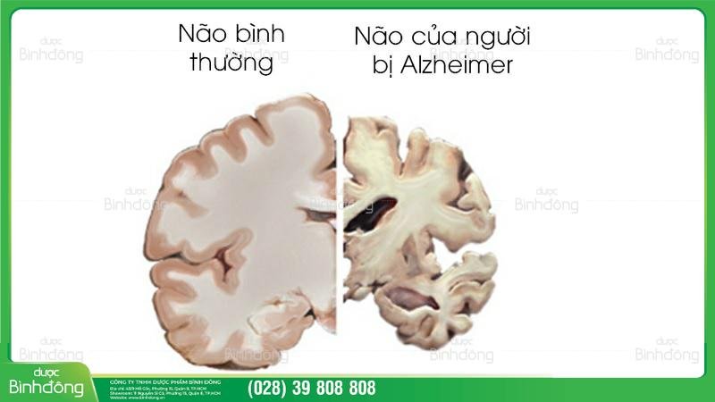 Hình ảnh về bộ não