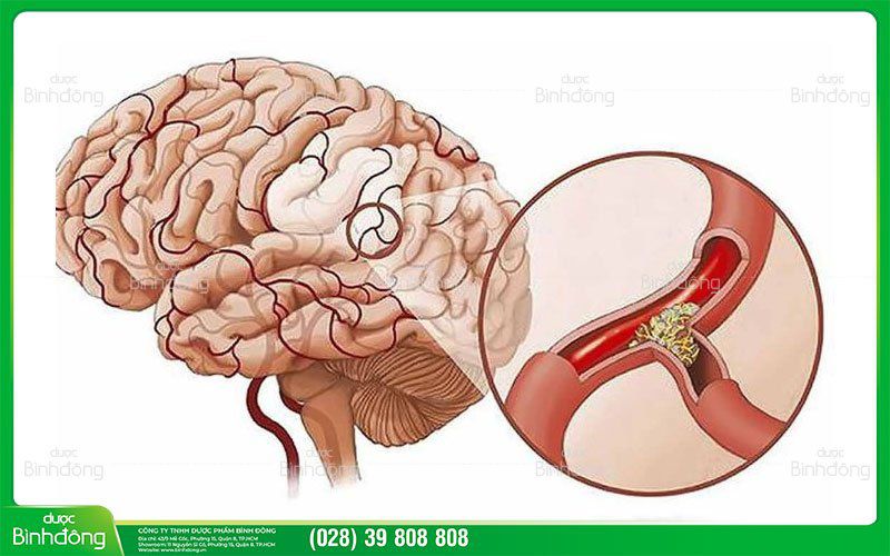 Tuần hoàn não là sự di chuyển của máu lên não qua các mạng lưới động mạch và tĩnh mạch.