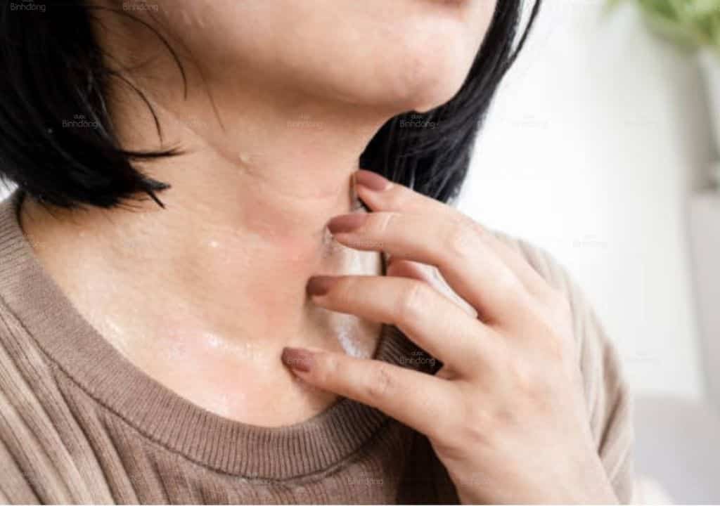 Hình ảnh người phụ nữ bị đổ mồ hôi nhiều