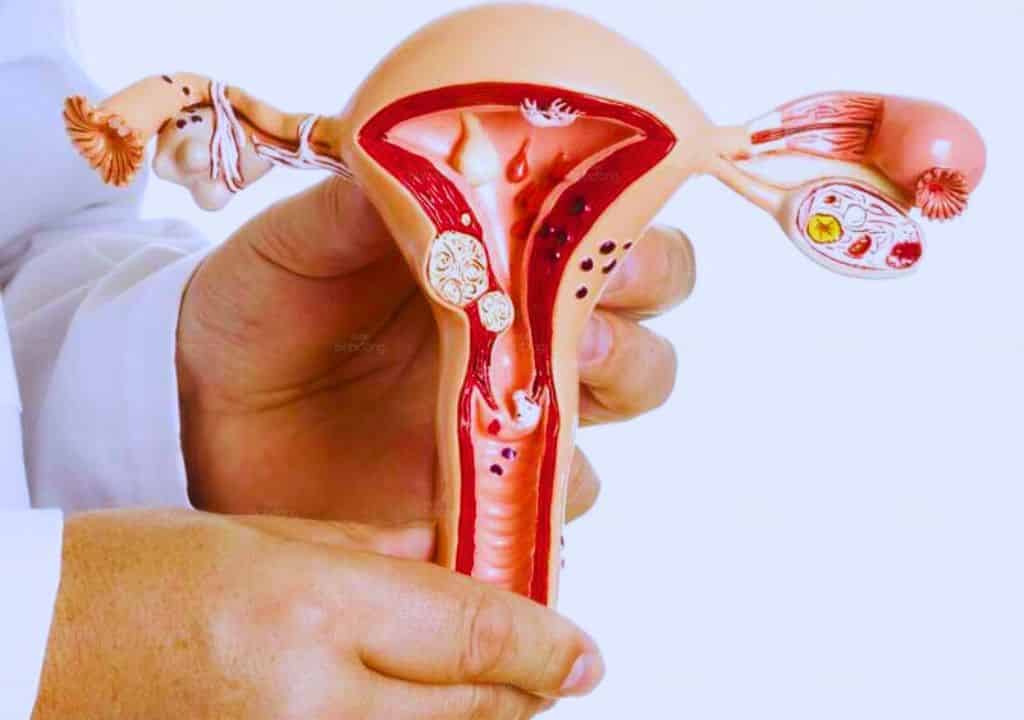 Hình ảnh về bộ phận phụ khoa của phụ nữ