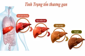 Hình ảnh tình trạng gan bị tổn thương