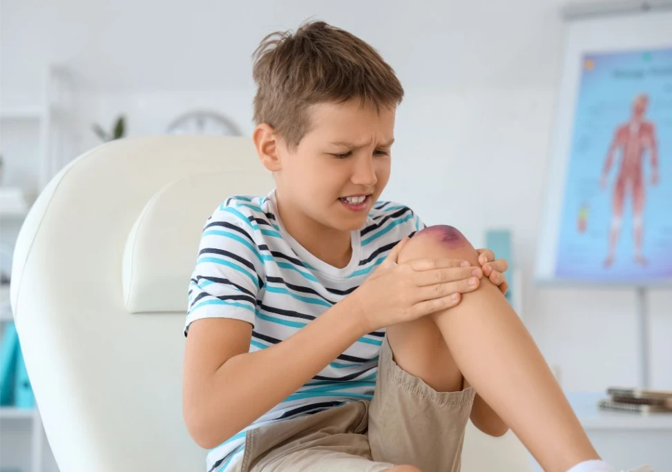 Hình ảnh trẻ bị bầm tím