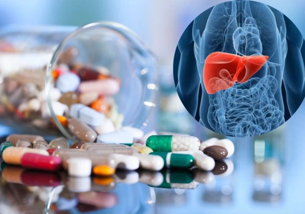 Hình ảnh uống quá nhiều loại thuốc dẫn đến tổn thương gan