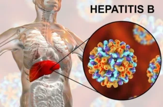 Hình ảnh về các bệnh nhân đang bị Viêm gan B