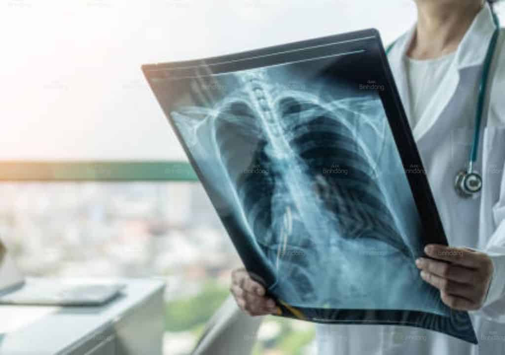 Thuốc trị viêm phế quản cấp