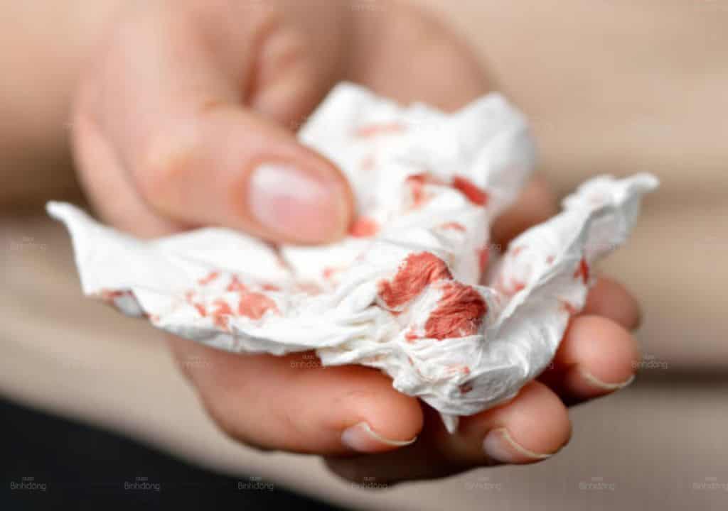7 cây thuốc nam trị ho ra máu