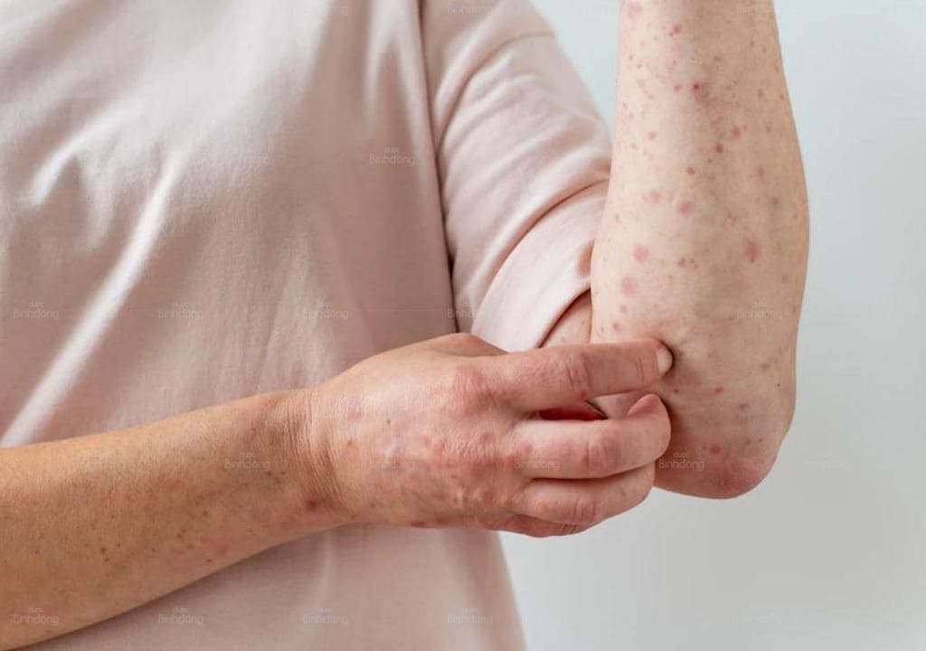 Thực phẩm chức năng điều trị viêm amidan