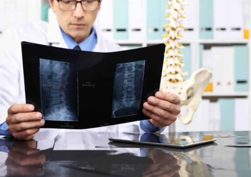 Đau nhức thần kinh tọa