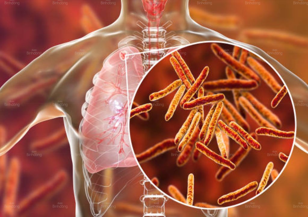 Hình ảnh giới thiệu về vi khuẩn lao tuberculosis