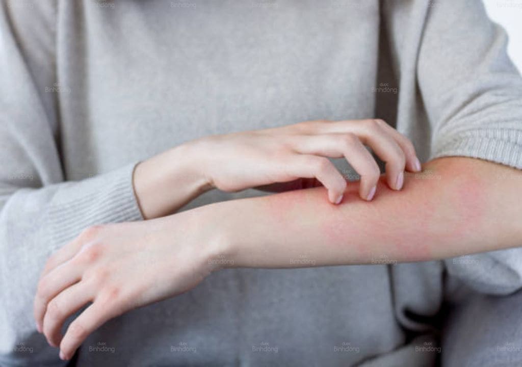 Hình ảnh người phụ nữ bị ngứa ngáy và cảm thấy vô cùng khó chịu
