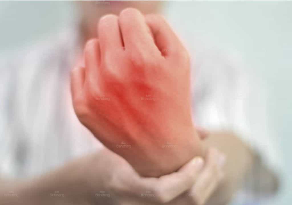 Hình ảnh về khớp ngón tay bị đỏ
