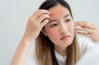 Thường xuyên bị nổi mẩn ngứa là do đâu?