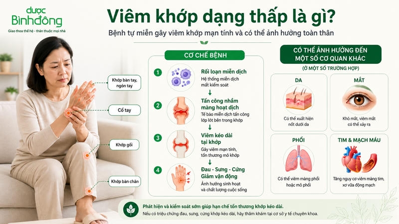 Infographic Viêm khớp dạng thấp là gì