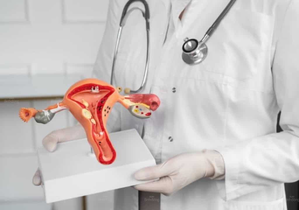 Hình ảnh rong kinh chỉ xảy ra khi buồng trứng bị tổn thương