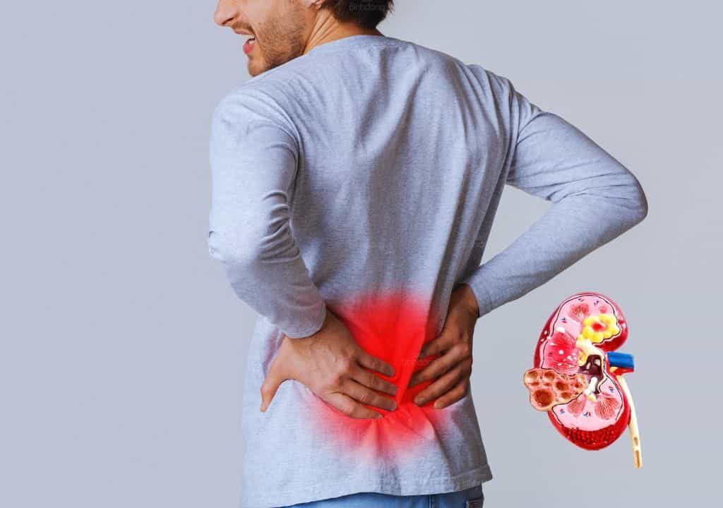 Hình ảnh về người đàn ông đang bị thận yếu