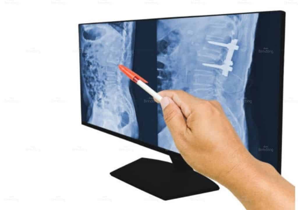 Hình ảnh của người bệnh nhân đang gặp tình trạng đau lưng dưới