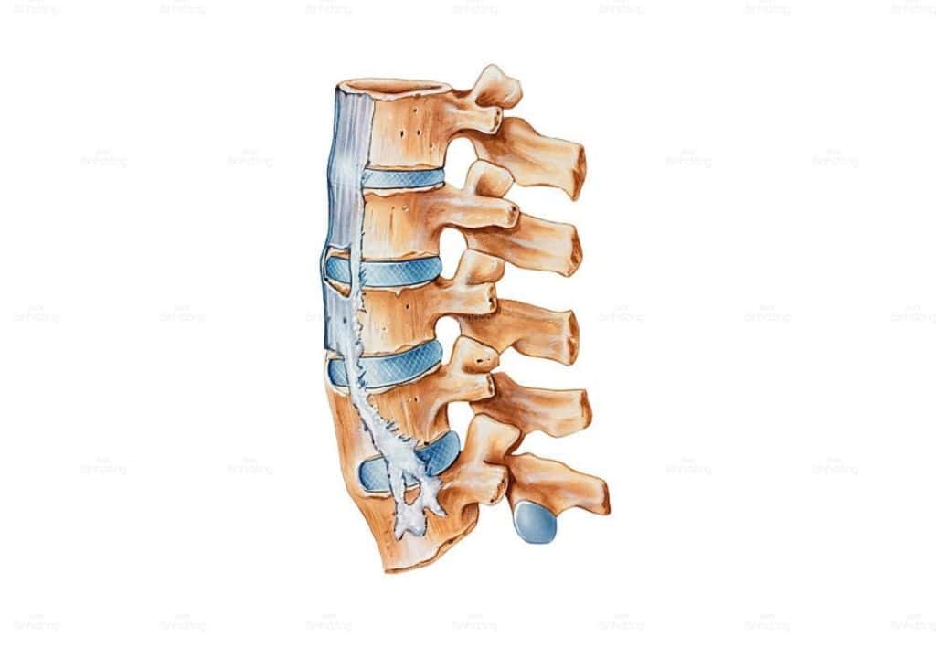 Hình ảnh mô phỏng bộ xương của bệnh nhân bị đau lưng dưới