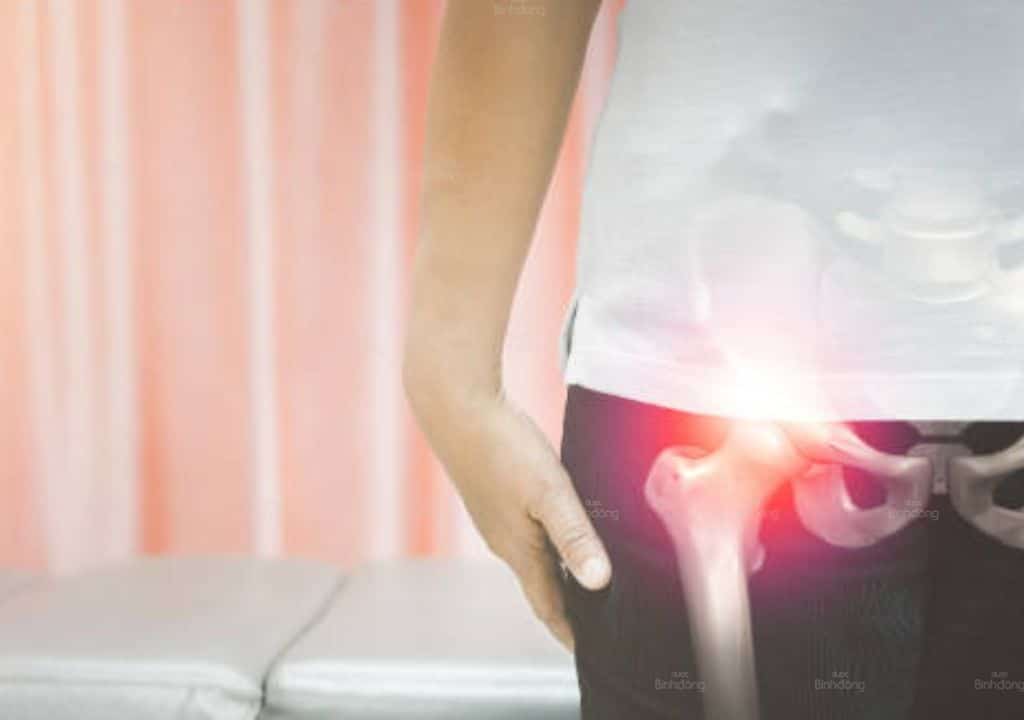 Hình ảnh bệnh nhân nam bị viêm khớp háng