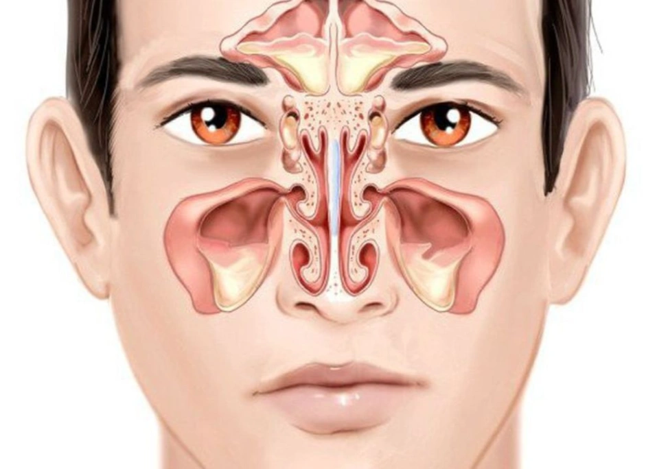 Hình ảnh viêm xoang ở người đàn ông