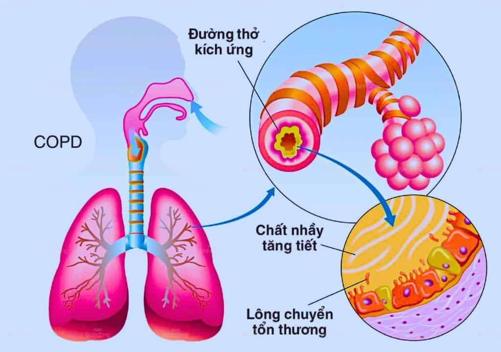 Hình ảnh về phổi và các bộ phận liên quan