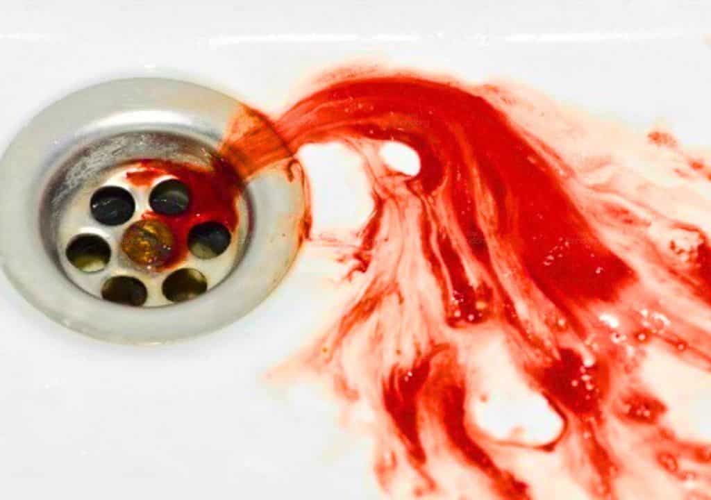 Hình ảnh về đờm màu đỏ kèm máu của người bệnh