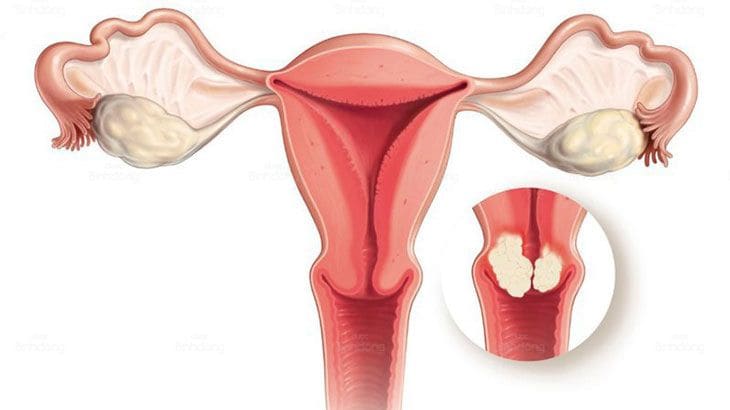 Hình ảnh về bộ phân phụ khoa của phụ nữ