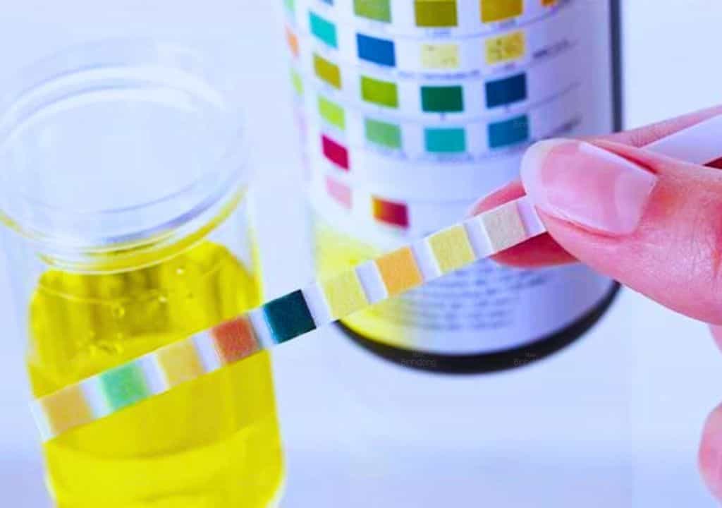 Hình ảnh về các màu nước tiểu