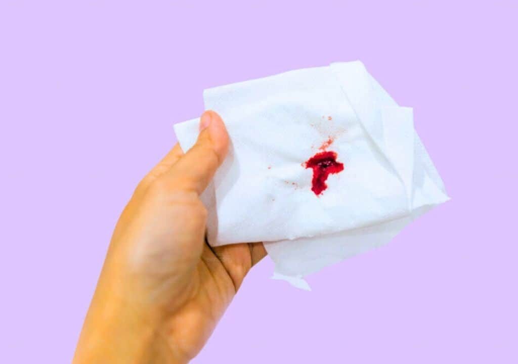 Hình ảnh về máu kinh ở phụ nữ