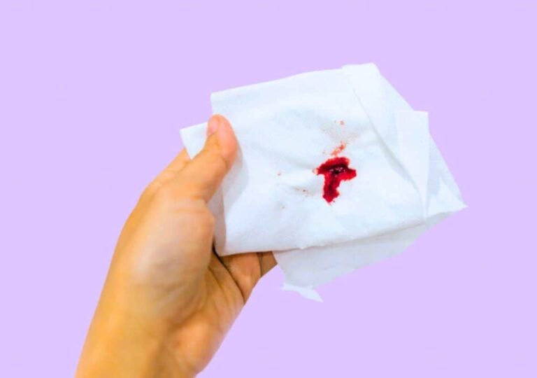 Hình ảnh về máu kinh ở phụ nữ