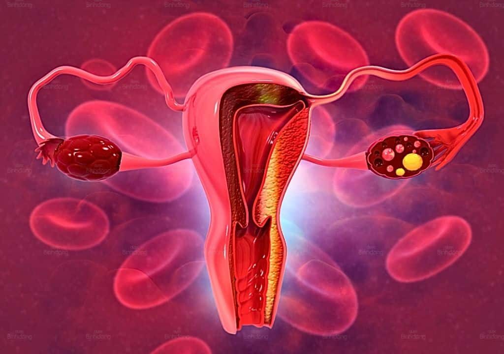 Hình ảnh về polyp tử cung