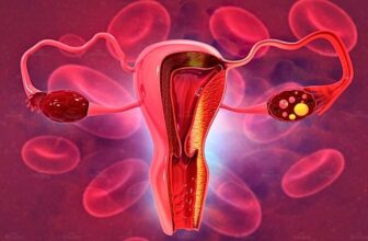 Hình ảnh về polyp tử cung
