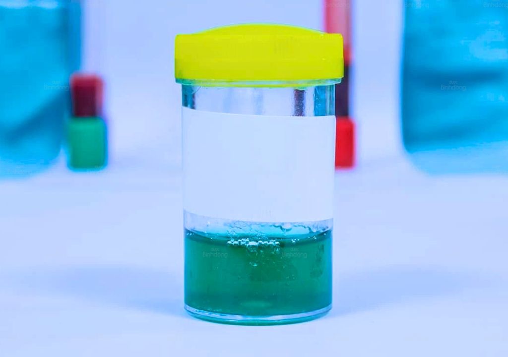 Hình chụp về nước tiểu màu xanh lá