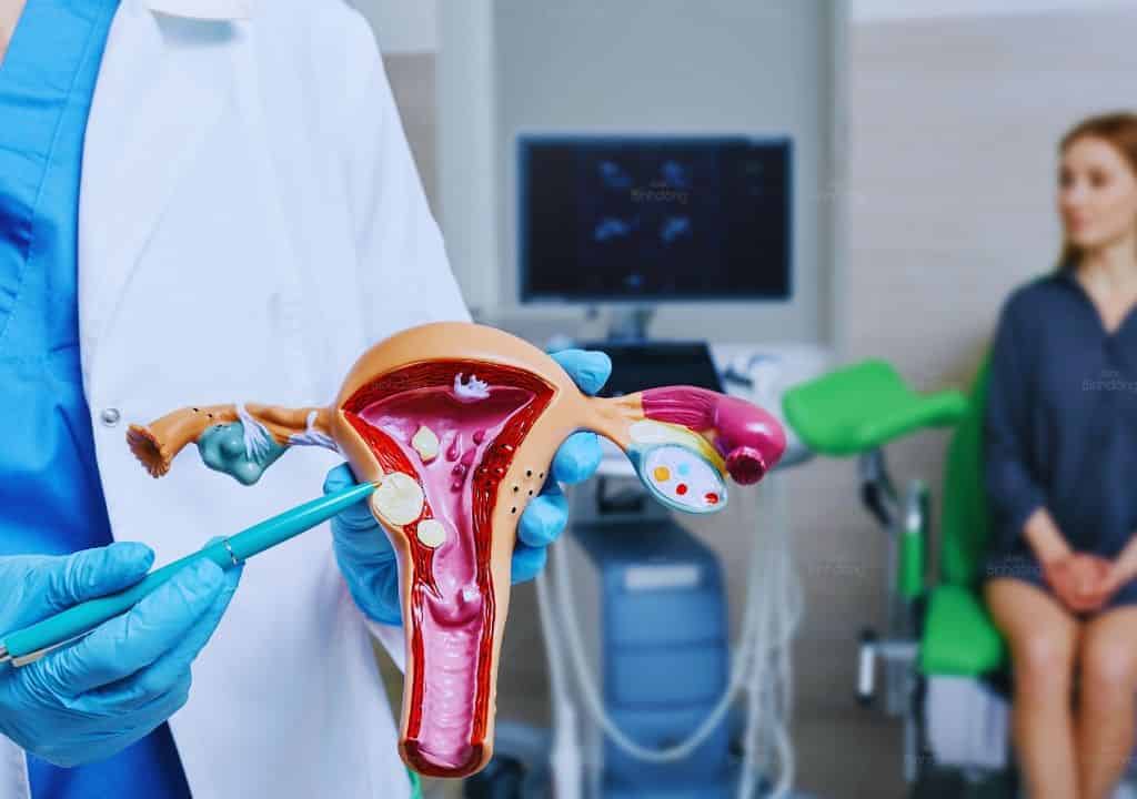 Hình ảnh người bác sĩ đang phân tích về bệnh viêm lộ tuyến tử cung