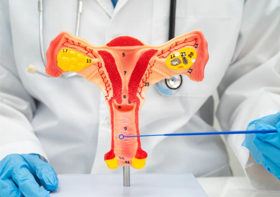 Hình ảnh về khí hư ở phụ nữ dấu hiệu cảnh báo polyp tử cung