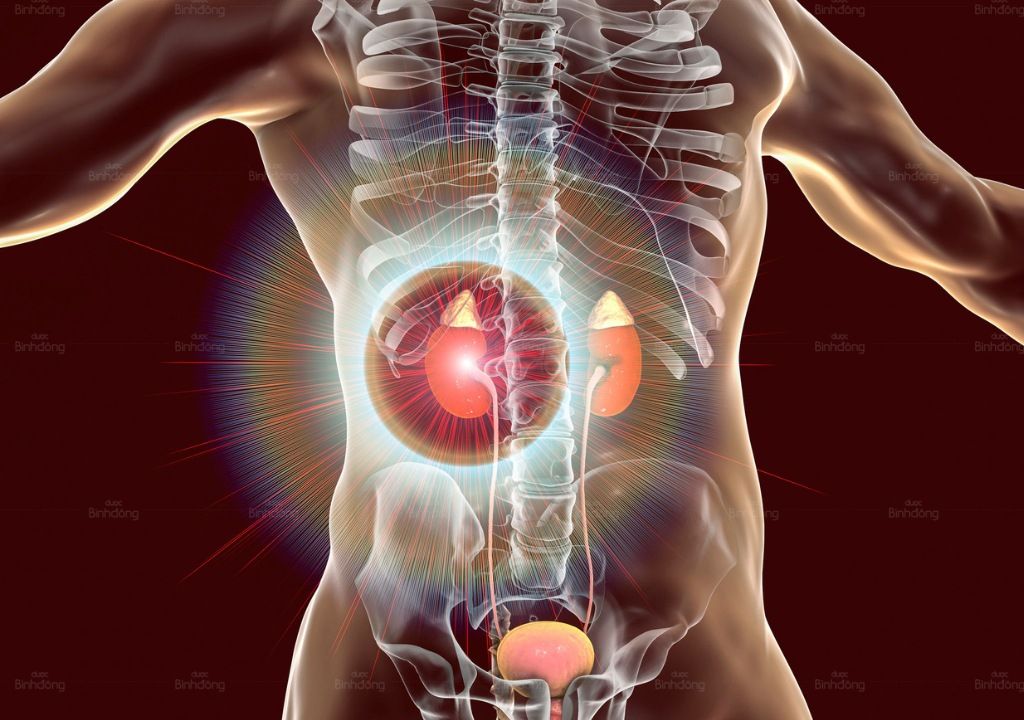 Hình chụp về Thận đang có vấn đề