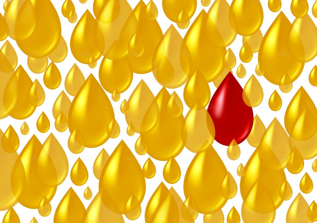 Hình chụp về nước tiểu có váng