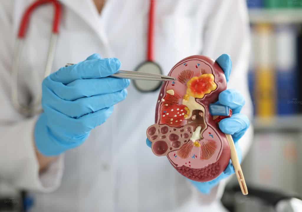 Hình ảnh về người bác sĩ đang nghiên cứu về mô hình quả thận trong cơ thể con người