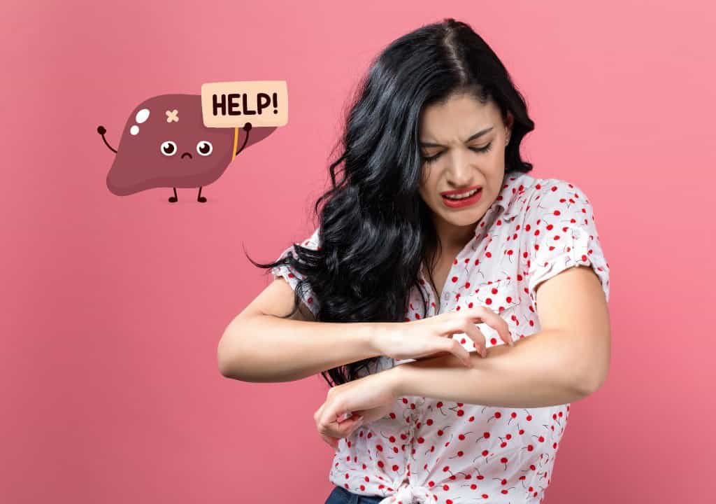 Hình ảnh người phụ nữ bị ngứa ở tay do gan bi yếu