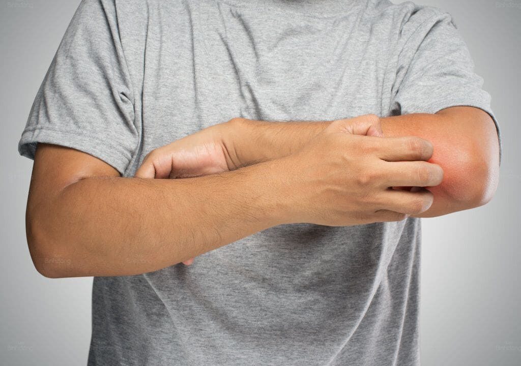 Hình ảnh người đàn ông đang bị ngứa tay vào ban đêm