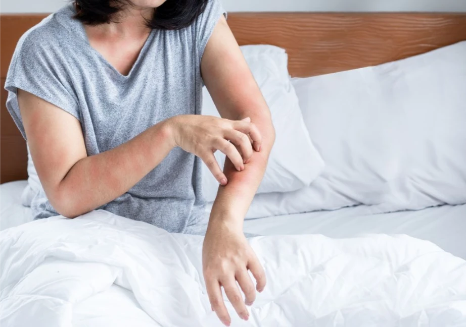 Hình ảnh người phụ nữ đang bị ngứa về đêm