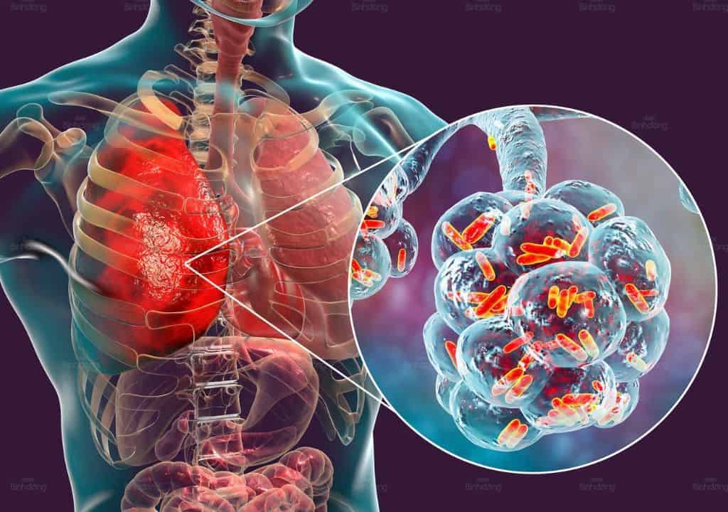 Hình ảnh về bộ phận phổi đang bị yếu