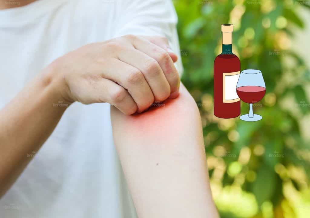 Hình ảnh người phụ nữ đang bị nổi mẩn đỏ ngứa ở vùng tay do uống rượu