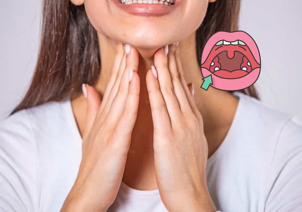 Hình ảnh người phụ nữ bị đờm vướng ở cổ họng và viêm amidan