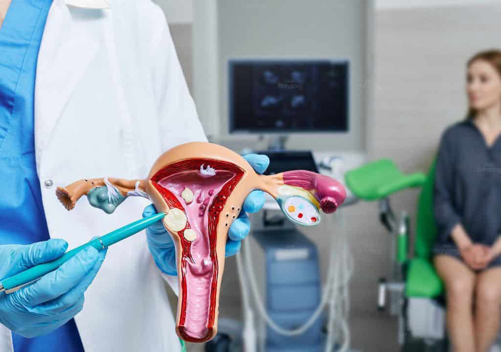 Hình ảnh người bác sĩ đang kiểm tra mô hình tử cung của phụ nữ