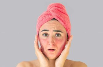Hình ảnh ngườ phụ nữ đang bị mẩn ngứa ở mặt