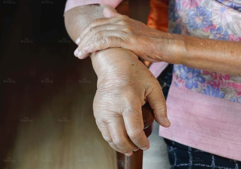 Hình ảnh bàn tay người phụ nữ đang bị phù nề cho sắp tới ngày đèn đỏ