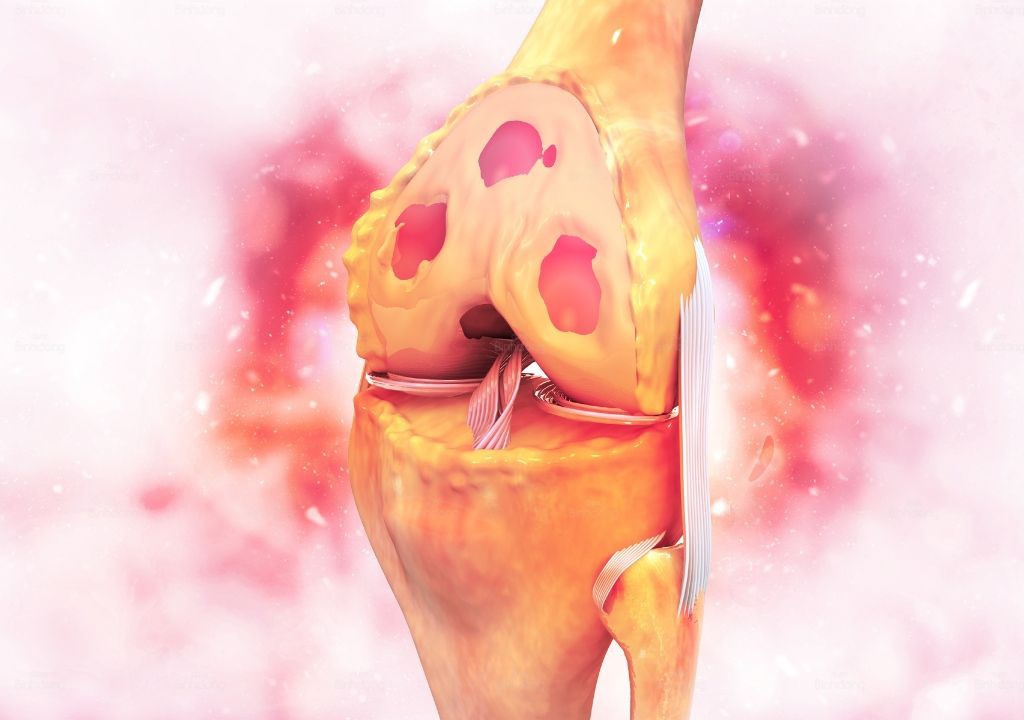 Hình chụp bộ phận xương khớp ở người