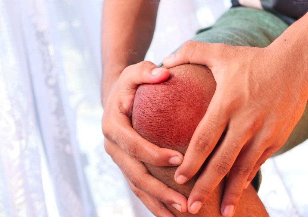 Hình chụp người đàn ông đang bị cứng khớp