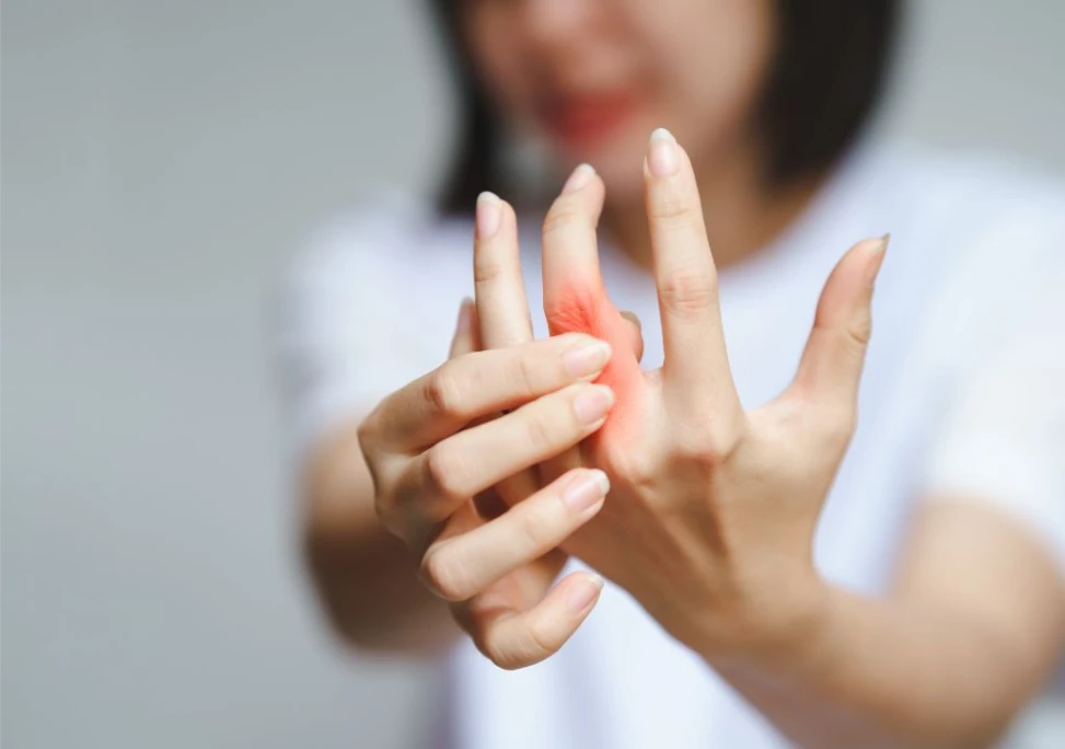 Người phụ nữ bị viêm khớp ngón tay